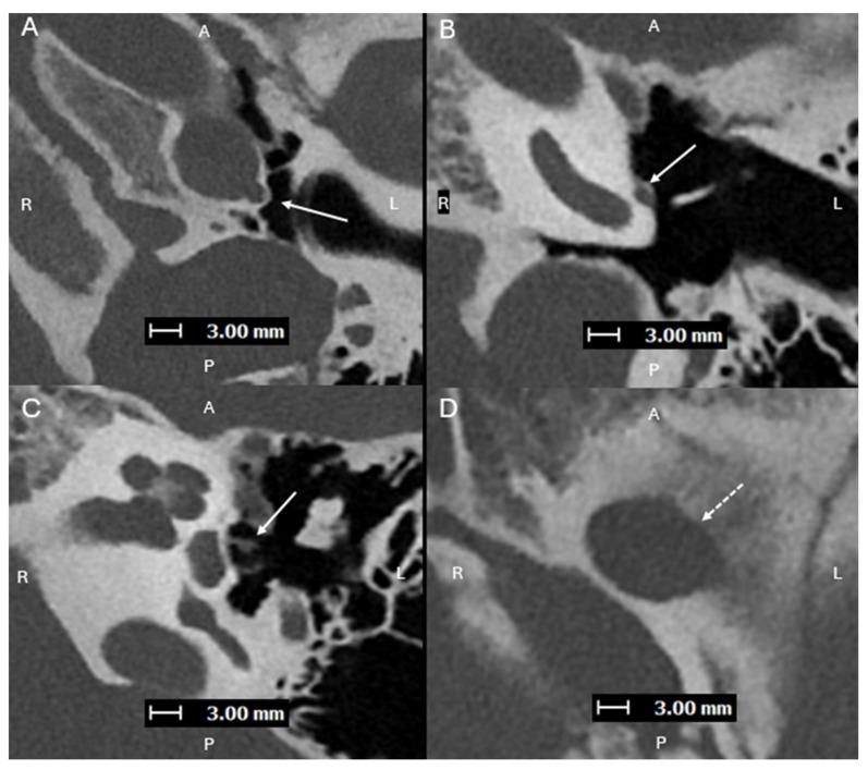 https://cdn.ncbi.nlm.nih.gov/pmc/blobs/b218/12427759/fd77a785c254/diagnostics-15-02213-g004.jpg