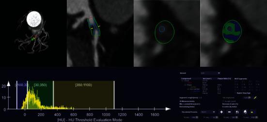 https://cdn.ncbi.nlm.nih.gov/pmc/blobs/b21b/8057896/7cdcfa8a13d4/OMCL2021-6663948.002.jpg