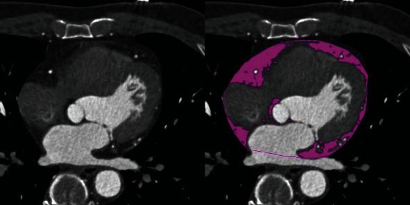 https://cdn.ncbi.nlm.nih.gov/pmc/blobs/b21b/8057896/a5750b1d7af4/OMCL2021-6663948.001.jpg