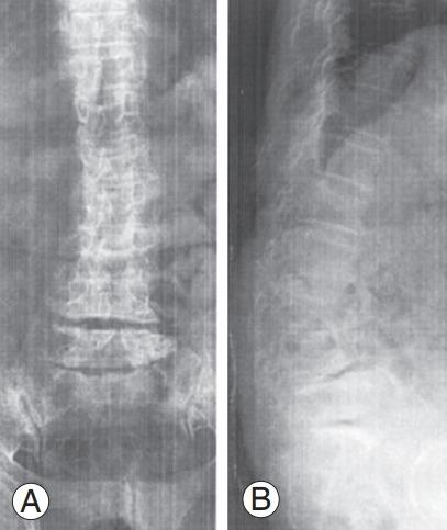 https://cdn.ncbi.nlm.nih.gov/pmc/blobs/b223/10622814/2075a93666c0/asj-2022-0199f6.jpg