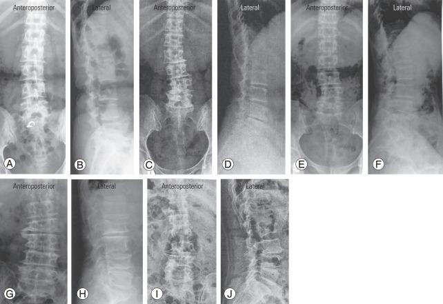 https://cdn.ncbi.nlm.nih.gov/pmc/blobs/b223/10622814/3bb55757e562/asj-2022-0199f17.jpg
