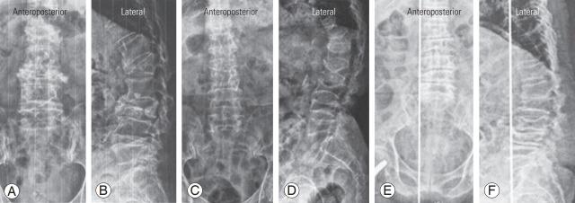 https://cdn.ncbi.nlm.nih.gov/pmc/blobs/b223/10622814/6407fdd556ae/asj-2022-0199f24.jpg