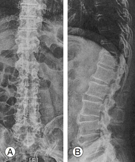 https://cdn.ncbi.nlm.nih.gov/pmc/blobs/b223/10622814/64fa4b7f5700/asj-2022-0199f10.jpg