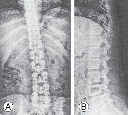 https://cdn.ncbi.nlm.nih.gov/pmc/blobs/b223/10622814/696b46dbbc6e/asj-2022-0199f3.jpg