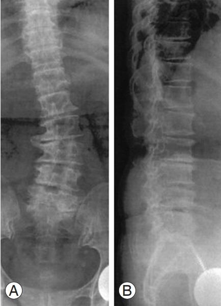 https://cdn.ncbi.nlm.nih.gov/pmc/blobs/b223/10622814/83169ff672ae/asj-2022-0199f20.jpg