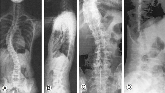 https://cdn.ncbi.nlm.nih.gov/pmc/blobs/b223/10622814/840102564eed/asj-2022-0199f12.jpg