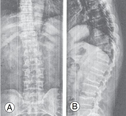 https://cdn.ncbi.nlm.nih.gov/pmc/blobs/b223/10622814/a8d60714681e/asj-2022-0199f4.jpg