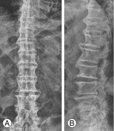 https://cdn.ncbi.nlm.nih.gov/pmc/blobs/b223/10622814/aa9197477410/asj-2022-0199f11.jpg