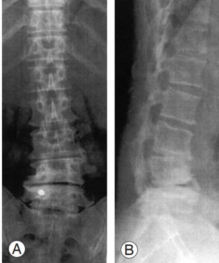 https://cdn.ncbi.nlm.nih.gov/pmc/blobs/b223/10622814/b6573b5a8f70/asj-2022-0199f18.jpg