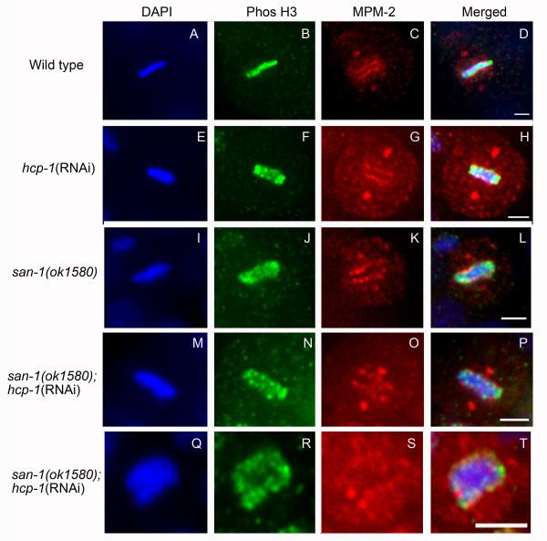 https://cdn.ncbi.nlm.nih.gov/pmc/blobs/b226/2265278/1cb19dfd9d36/1747-1028-3-6-6.jpg