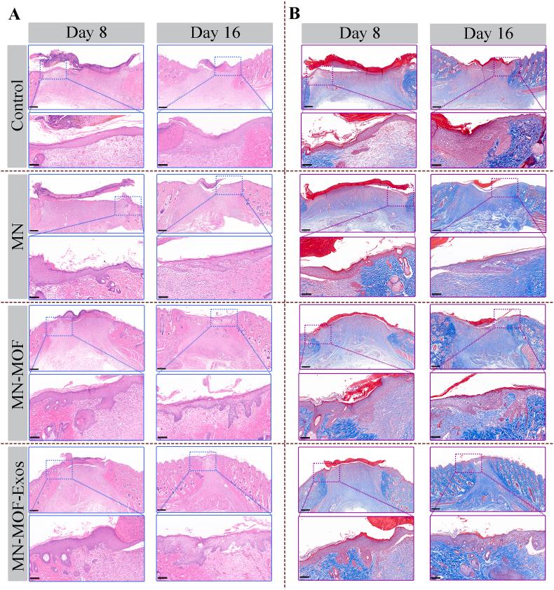 https://cdn.ncbi.nlm.nih.gov/pmc/blobs/b229/12284567/b969b7766a4d/gr13.jpg