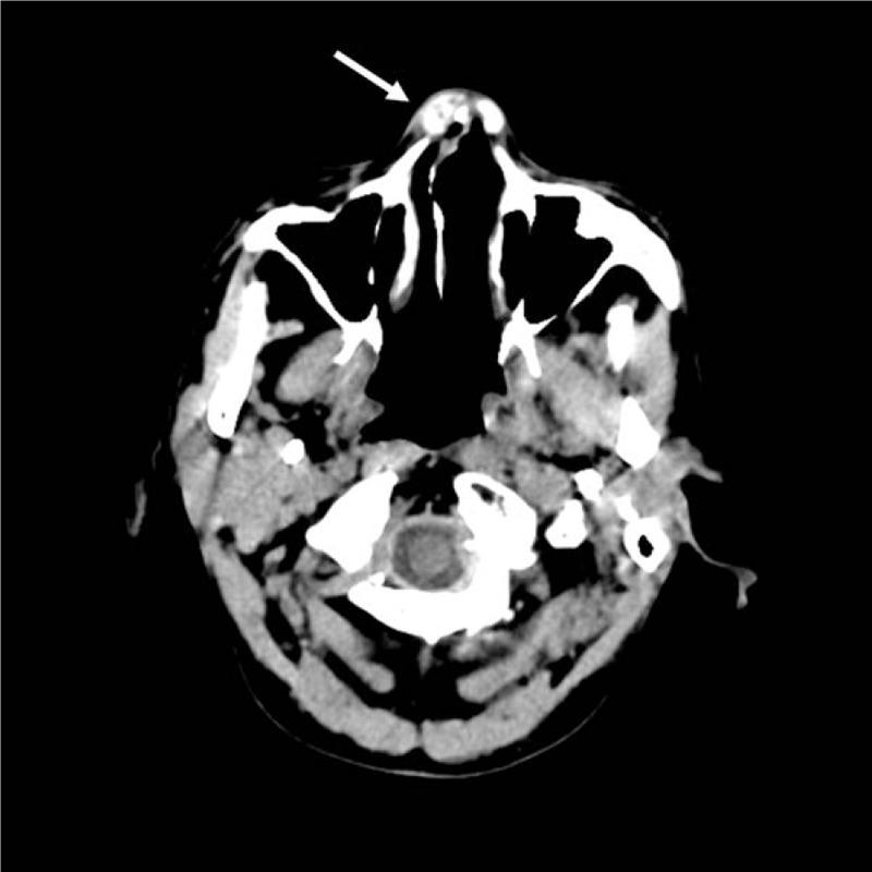 https://cdn.ncbi.nlm.nih.gov/pmc/blobs/b229/6426609/0cddcff1f6b0/medi-98-e14850-g002.jpg