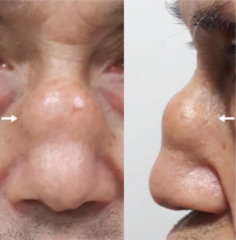 https://cdn.ncbi.nlm.nih.gov/pmc/blobs/b229/6426609/8951282f1022/medi-98-e14850-g001.jpg