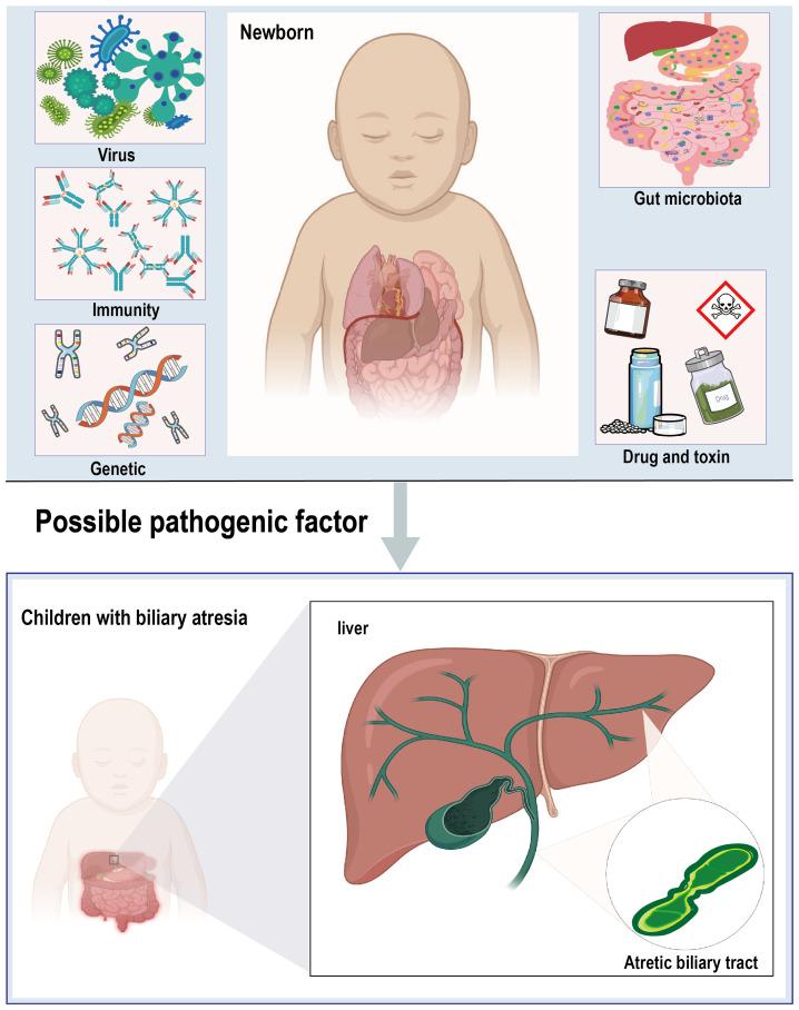 https://cdn.ncbi.nlm.nih.gov/pmc/blobs/b231/11298464/c9944d6ff7cd/fcimb-14-1411843-g001.jpg