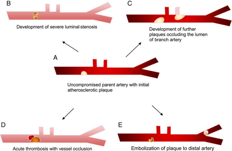 https://cdn.ncbi.nlm.nih.gov/pmc/blobs/b237/10552953/4a94c3cffb77/ms9-85-4903-g001.jpg