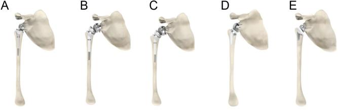 https://cdn.ncbi.nlm.nih.gov/pmc/blobs/b239/11044086/b9e671d48231/EOR-23-0106fig8.jpg
