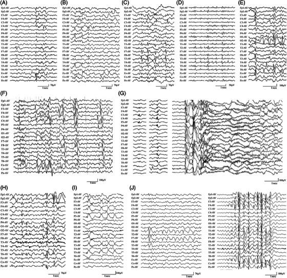 https://cdn.ncbi.nlm.nih.gov/pmc/blobs/b23c/10235798/279807393899/CTM2-13-e1289-g002.jpg