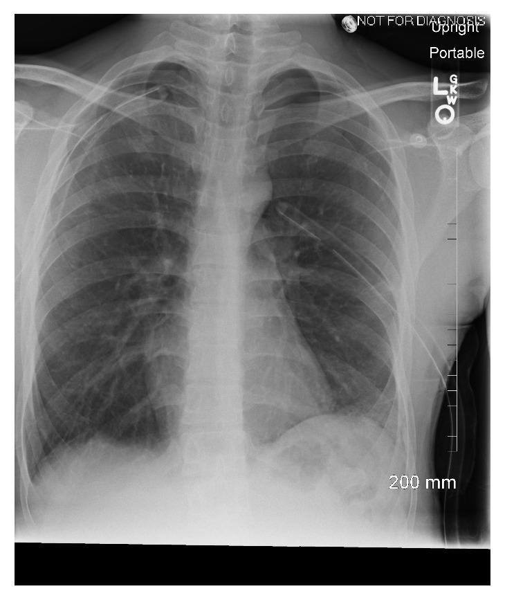 https://cdn.ncbi.nlm.nih.gov/pmc/blobs/b23c/6369490/a418d1ee5b95/CRIPU2019-6583842.002.jpg