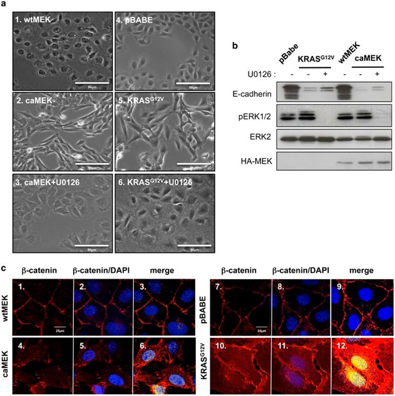 https://cdn.ncbi.nlm.nih.gov/pmc/blobs/b240/4687460/5c7e1f120403/onc2014416f1.jpg