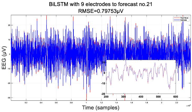 https://cdn.ncbi.nlm.nih.gov/pmc/blobs/b248/11359714/51824de0353a/sensors-24-05215-g009a.jpg