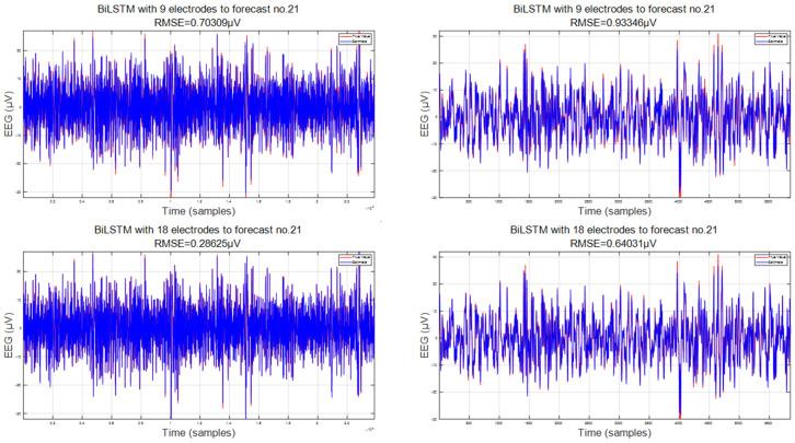 https://cdn.ncbi.nlm.nih.gov/pmc/blobs/b248/11359714/70354df6ba71/sensors-24-05215-g008.jpg