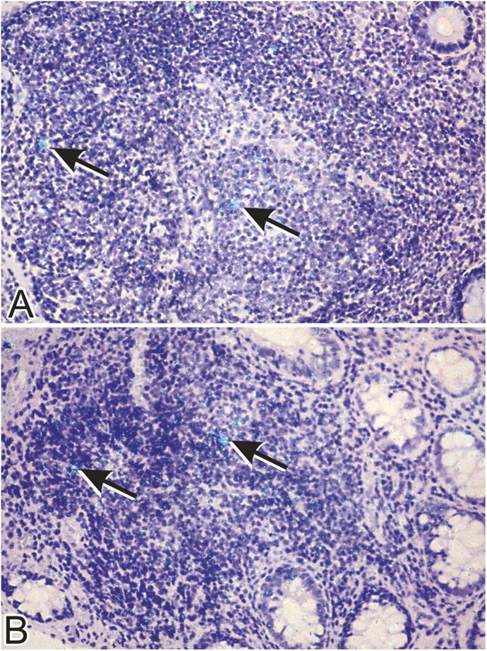 https://cdn.ncbi.nlm.nih.gov/pmc/blobs/b24a/2211967/39d61370865f/20041196f4.jpg