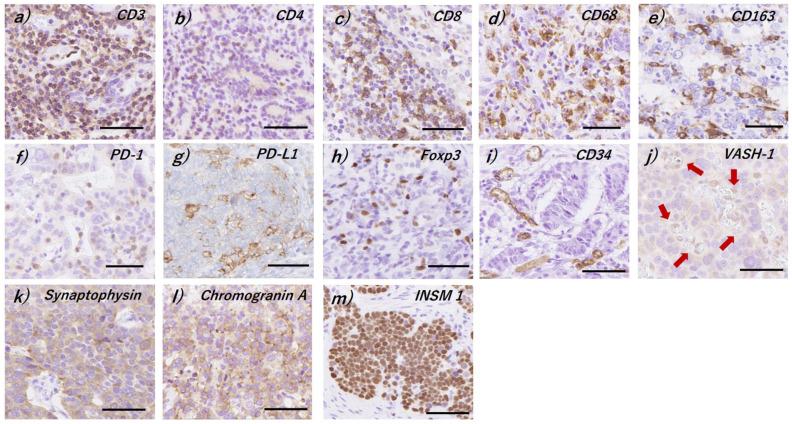 https://cdn.ncbi.nlm.nih.gov/pmc/blobs/b251/9100554/7e911dcedad9/cancers-14-02152-g001.jpg