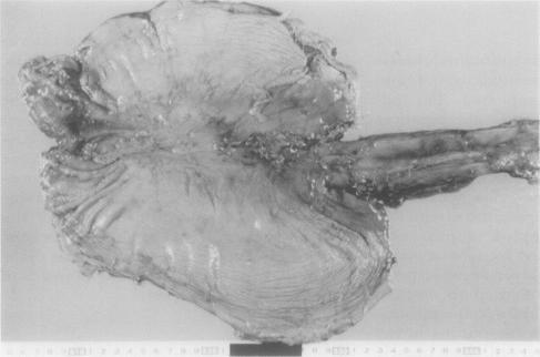 https://cdn.ncbi.nlm.nih.gov/pmc/blobs/b253/500275/b58449d61043/jclinpath00259-0076-b.jpg