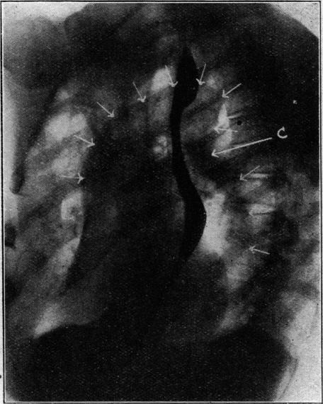 https://cdn.ncbi.nlm.nih.gov/pmc/blobs/b254/2058690/0a042a25fc48/brmedj03827-0005-b.jpg