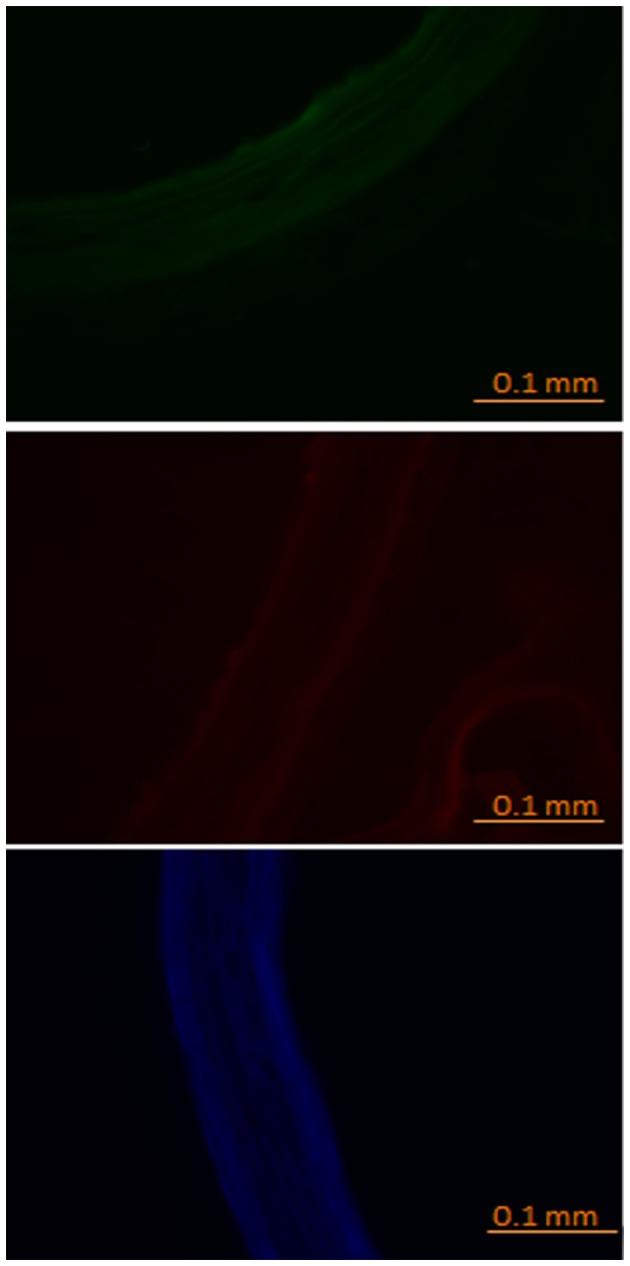 https://cdn.ncbi.nlm.nih.gov/pmc/blobs/b255/5671568/10ffe45e1773/fphys-08-00861-g0005.jpg