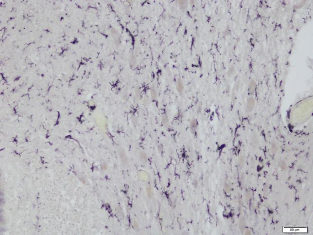 https://cdn.ncbi.nlm.nih.gov/pmc/blobs/b258/9388452/e02aabc8316b/406_2021_1334_Fig1_HTML.jpg