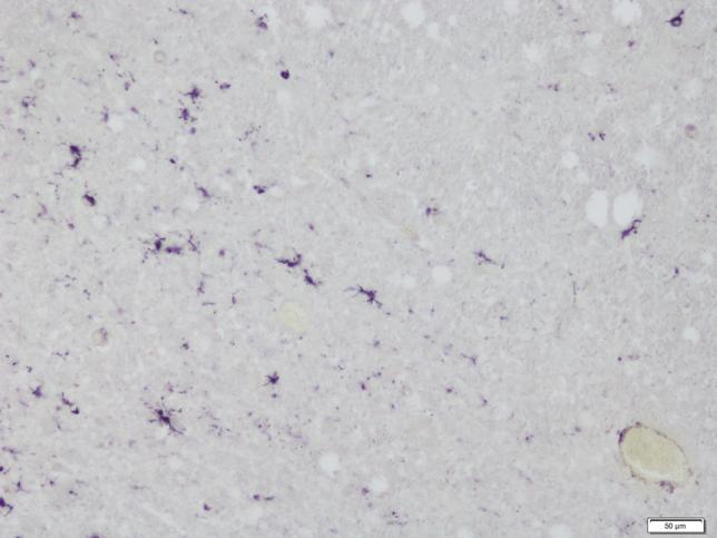 https://cdn.ncbi.nlm.nih.gov/pmc/blobs/b258/9388452/e6292a302fa9/406_2021_1334_Fig2_HTML.jpg