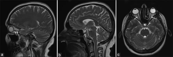 https://cdn.ncbi.nlm.nih.gov/pmc/blobs/b259/9175437/c6aed7070112/AIAN-25-214-g001.jpg