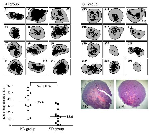 https://cdn.ncbi.nlm.nih.gov/pmc/blobs/b25e/2408928/d13f87fd8a7e/1471-2407-8-122-5.jpg