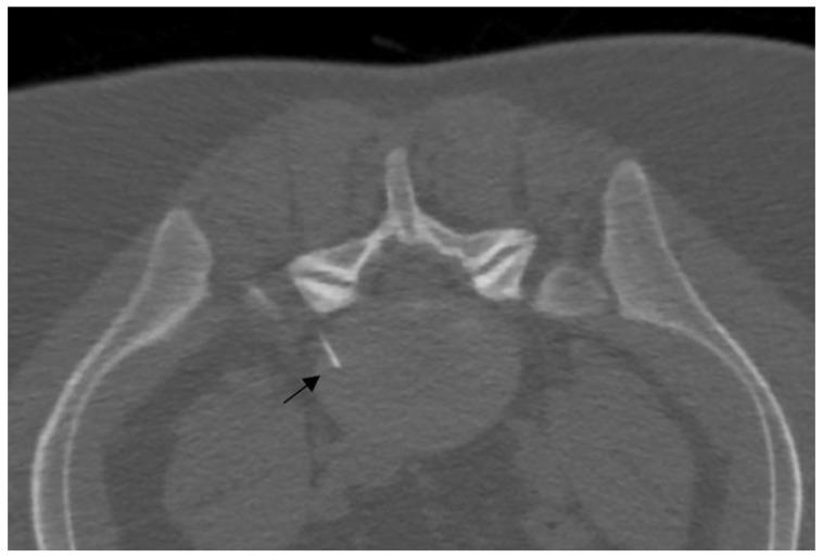 https://cdn.ncbi.nlm.nih.gov/pmc/blobs/b264/11171713/01426f6fd706/diagnostics-14-01147-g003.jpg