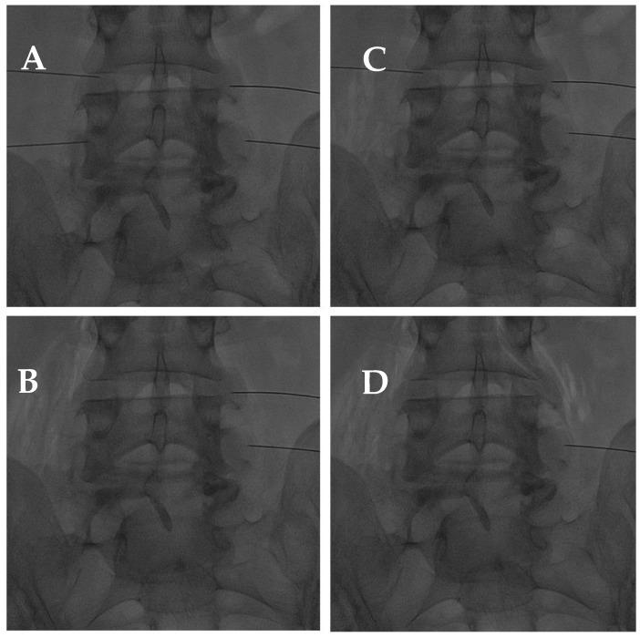 https://cdn.ncbi.nlm.nih.gov/pmc/blobs/b264/11171713/51fd520289a4/diagnostics-14-01147-g010.jpg