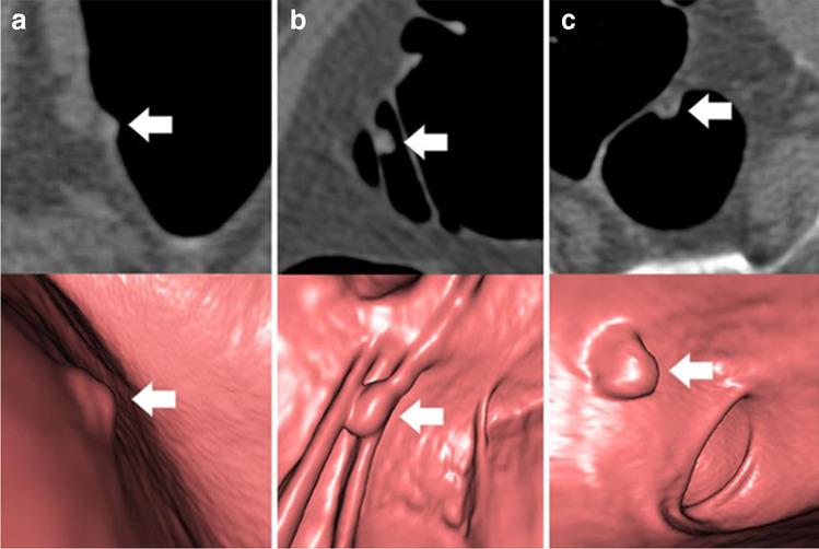 https://cdn.ncbi.nlm.nih.gov/pmc/blobs/b264/9213389/5c659e73a876/330_2021_8532_Fig2_HTML.jpg