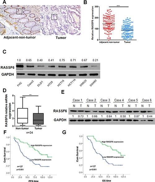 https://cdn.ncbi.nlm.nih.gov/pmc/blobs/b265/5589649/3aa4f947e6b5/oncotarget-08-55162-g001.jpg
