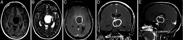 https://cdn.ncbi.nlm.nih.gov/pmc/blobs/b269/11151091/0d74dea64537/CASE24131f1.jpg
