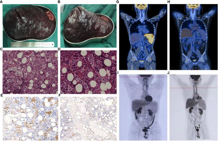 https://cdn.ncbi.nlm.nih.gov/pmc/blobs/b26a/10859473/00c124e197af/fonc-14-1345464-g001.jpg