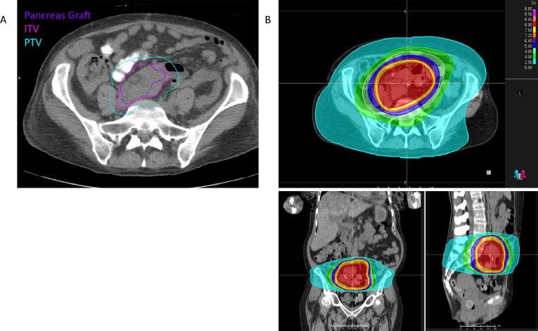 https://cdn.ncbi.nlm.nih.gov/pmc/blobs/b26a/9871068/fc3ee0fadcf2/gr1.jpg