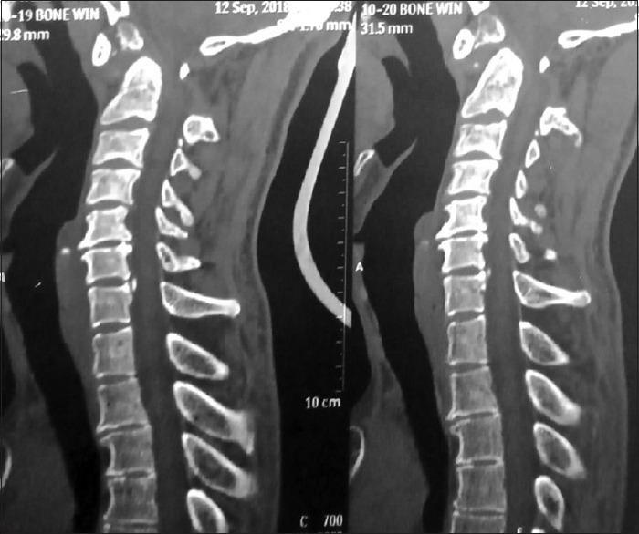 https://cdn.ncbi.nlm.nih.gov/pmc/blobs/b276/7057904/dc464f120a95/AJNS-15-236-g002.jpg