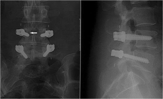 https://cdn.ncbi.nlm.nih.gov/pmc/blobs/b27a/4736269/8fa67990acfa/12891_2016_913_Fig4_HTML.jpg
