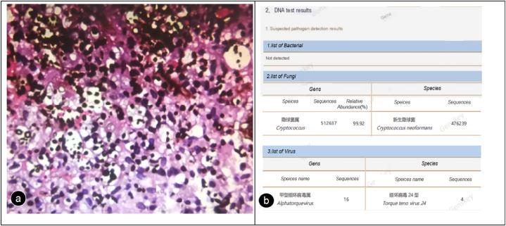 https://cdn.ncbi.nlm.nih.gov/pmc/blobs/b281/11471500/84af4299ded6/gr4.jpg