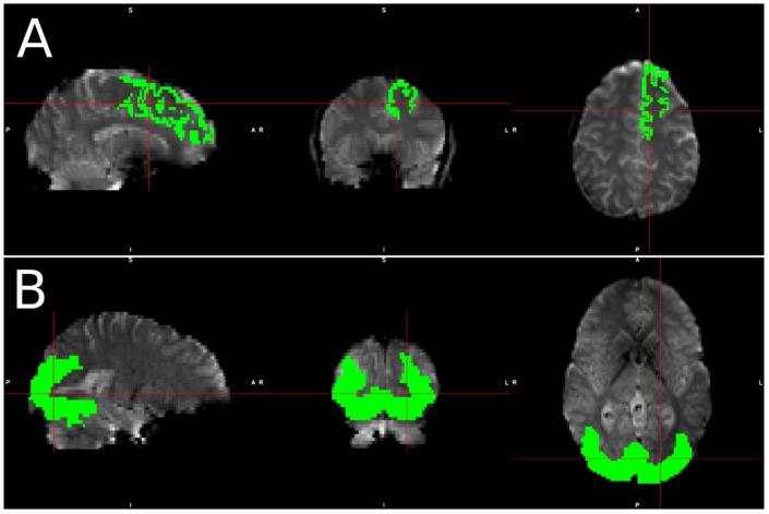https://cdn.ncbi.nlm.nih.gov/pmc/blobs/b281/6736626/a5fadc38d6a2/fnins-13-00821-g001.jpg
