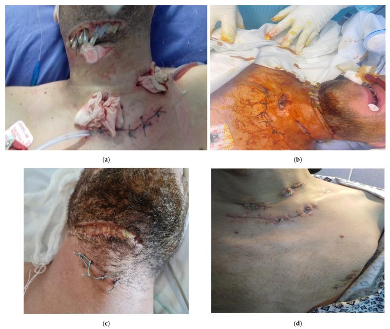 https://cdn.ncbi.nlm.nih.gov/pmc/blobs/b281/9965330/2ea9e0255fe8/life-13-00535-g006a.jpg