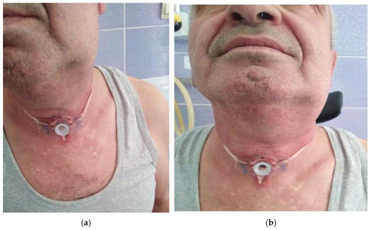 https://cdn.ncbi.nlm.nih.gov/pmc/blobs/b281/9965330/60a2c172147f/life-13-00535-g004.jpg