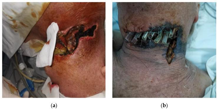 https://cdn.ncbi.nlm.nih.gov/pmc/blobs/b281/9965330/eabcf5baae65/life-13-00535-g001.jpg