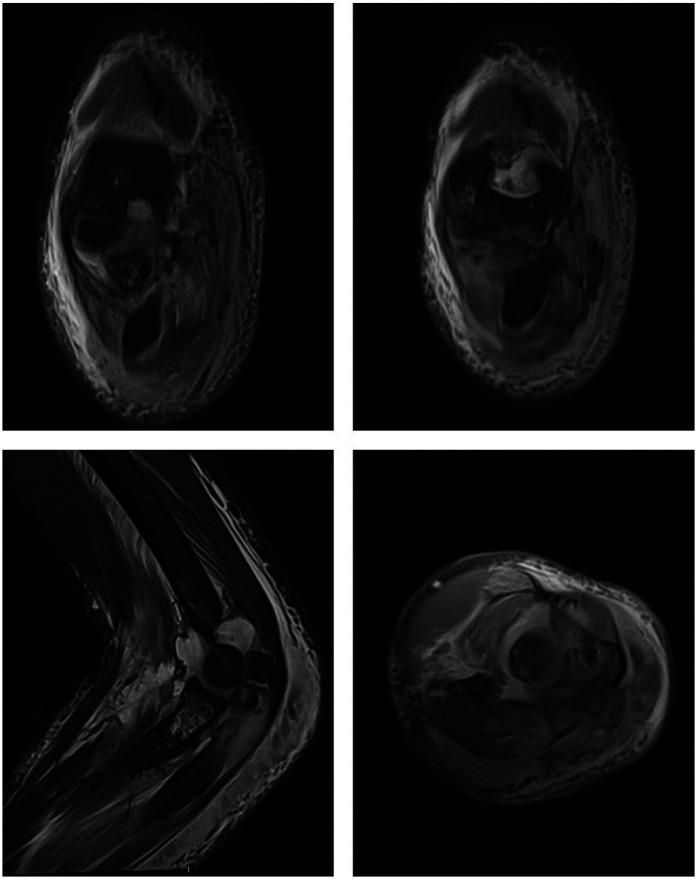https://cdn.ncbi.nlm.nih.gov/pmc/blobs/b283/12392106/896be1d01409/fsurg-12-1487129-g002.jpg