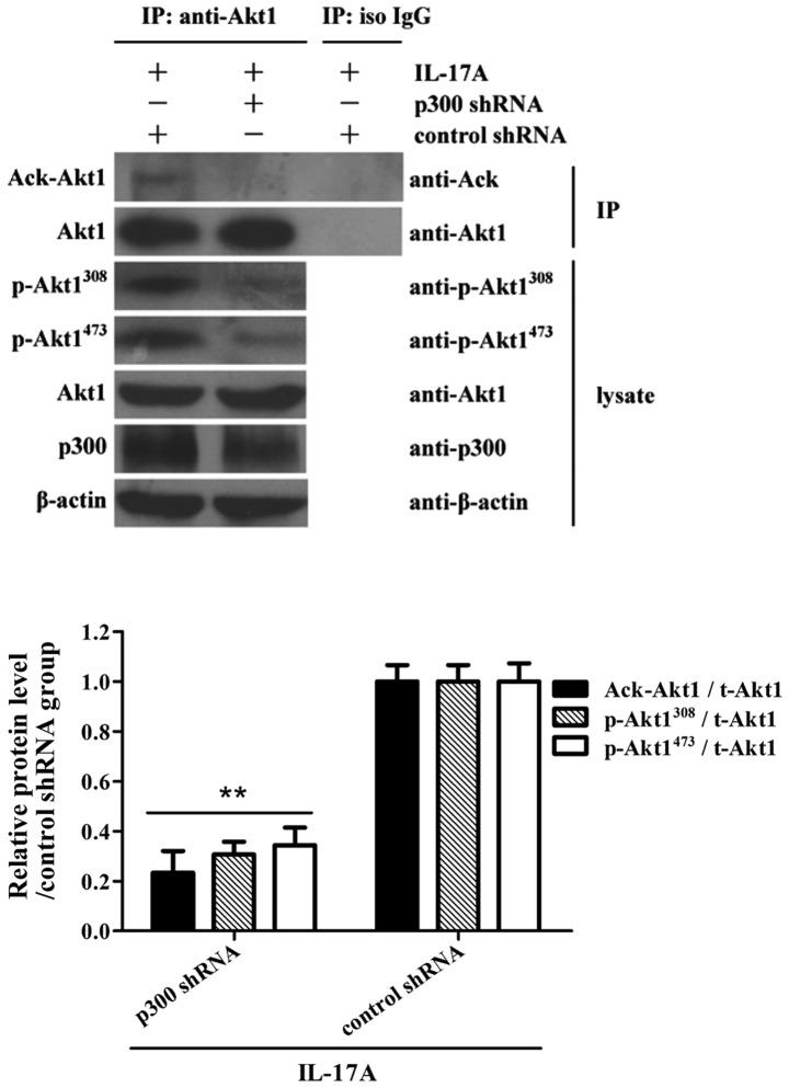 https://cdn.ncbi.nlm.nih.gov/pmc/blobs/b287/5452892/d929a44b9f9a/ol-13-06-4238-g03.jpg